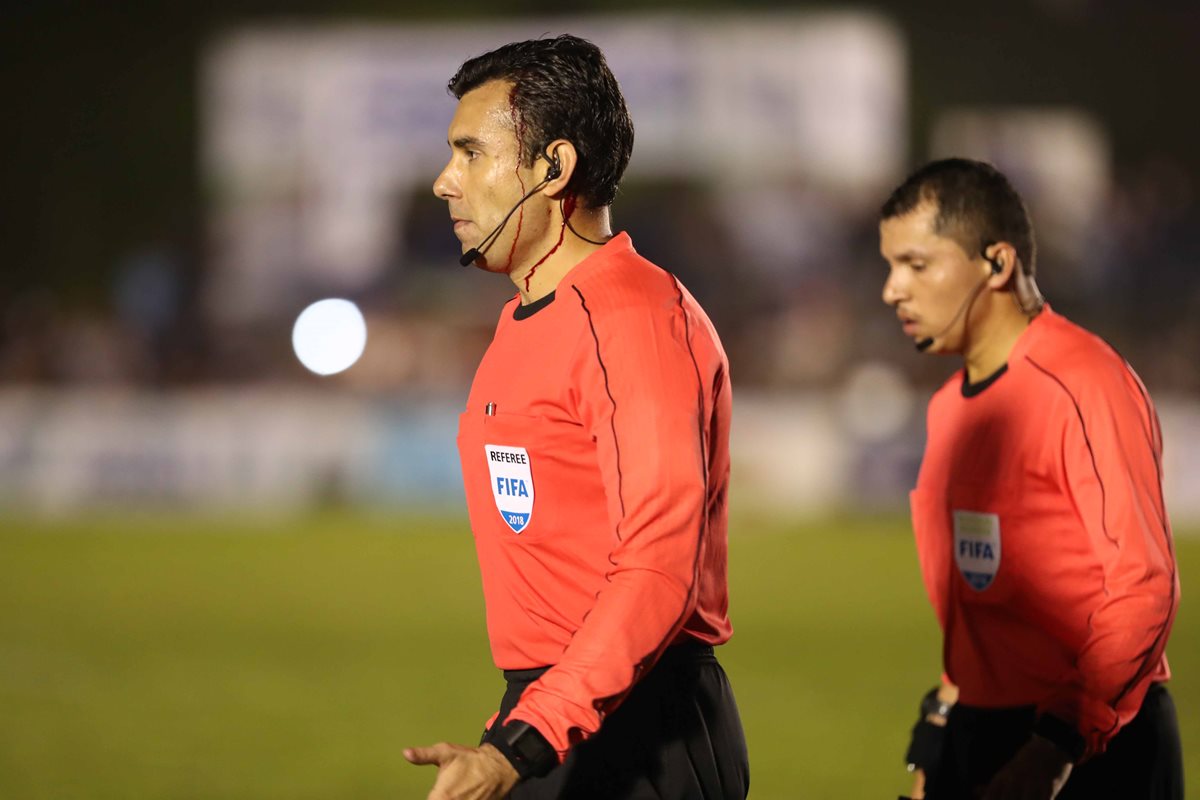 El árbitro Mario Escobar tuvo que ser suturado con tres puntos por la herida en su cabeza. (Foto Prensa Libre: Hemeroteca PL)
