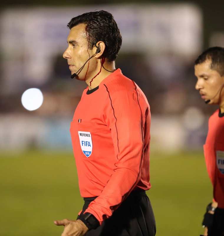 El árbitro Mario Escobar tuvo que ser suturado con tres puntos por la herida en su cabeza. (Foto Prensa Libre: Hemeroteca PL)