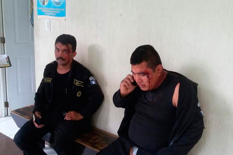 Los dos agentes que fueron retenidos por contrabandistas para rescatar mercadería decomisada resultaron con golpes en el rostro. (Foto Prensa Libre: Whitmer Barrera)
