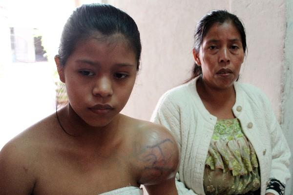 Sebastiana Esther Choj, muestra  tumor.