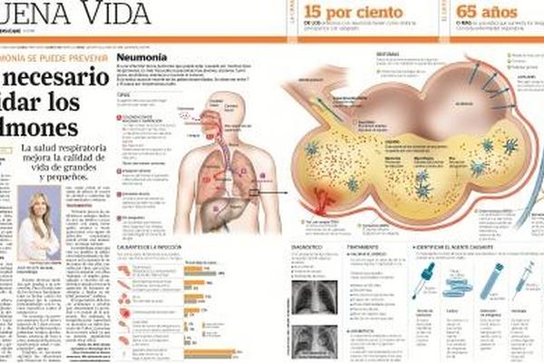 Desarrollo y prevención de la neumonía