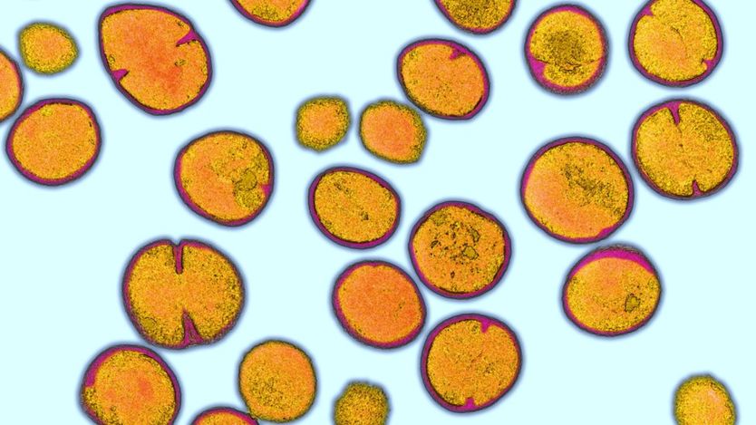 Se encontró tres veces más Staphylococcus aureus resistente a la meticilina (SARM) en los baños que usaron secadores de aire que en los que tenían toallas de papel desechables. (Foto Prensa Libre: GETTY IMAGES)