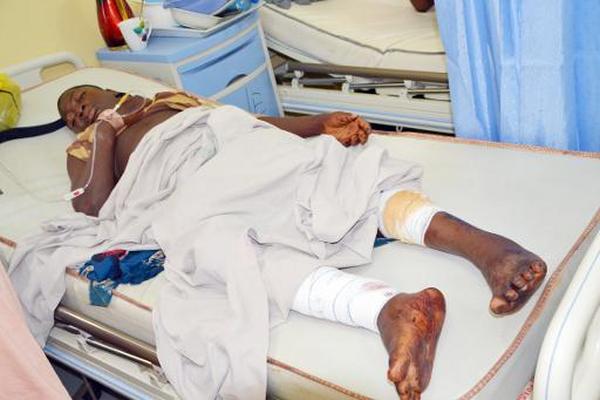 Un herido por la explosión de una bomba se recupera en un hospital en Abuja. (Foto Prensa Libre: AFP).