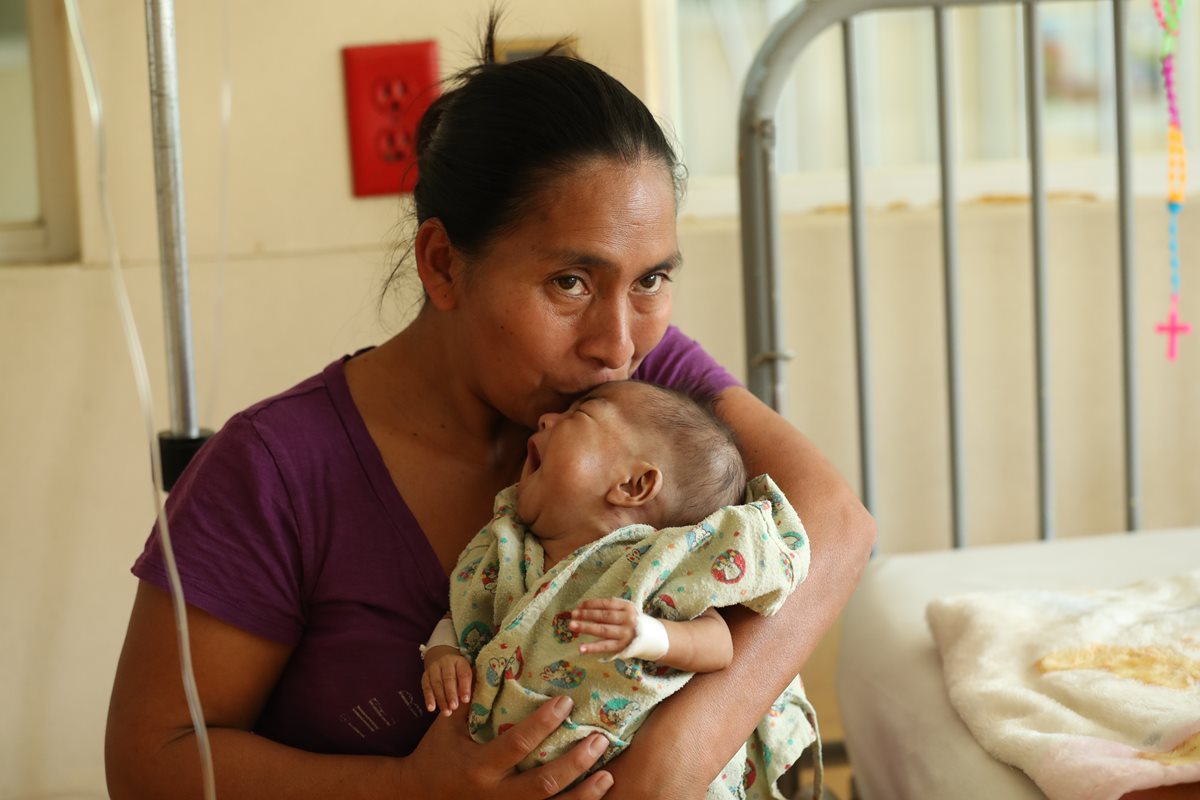 Alma Victoria Martínez toma entre sus brazos a su hija Graciela Esmeralda, quien sobrevivió a  la cirugía de separación de su hermana siamesas. (Foto Prensa Libre: Hemeroteca PL)