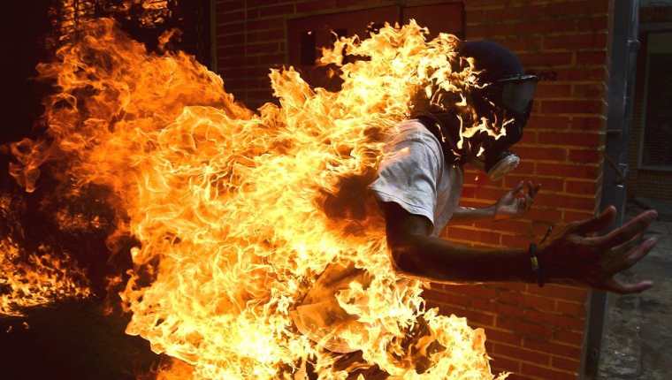 Este miércoles un manifestante terminó prendido en llamas durante las protestas en Venezuela, después de que una moto explotara cuando él saltaba sobre ella. AFP/RONALDO SCHEMIDT