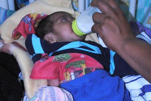 Más casos de desnutrición severa han sido atendidos en centros de recuperación de Coatepeque, Quetzaltenango. (Foto Prensa Libre, Édgar Girón)<br _mce_bogus="1"/>
