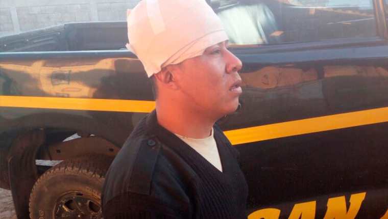 El agente Vinicio Israel Pérez Ixtamer fue agredido por la turba. (Foto Prensa Libre: Cortesía)