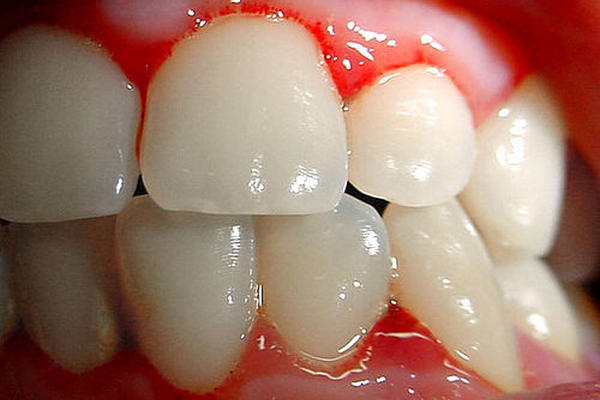 <br _mce_bogus="1"/>