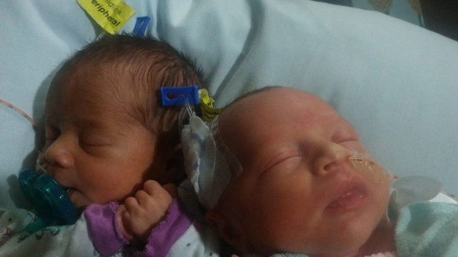 Darla (izquierda) y Delanie nacieron el pasado 17 de junio, poco más de un año después que sus hermanas.DANESHA COUCH