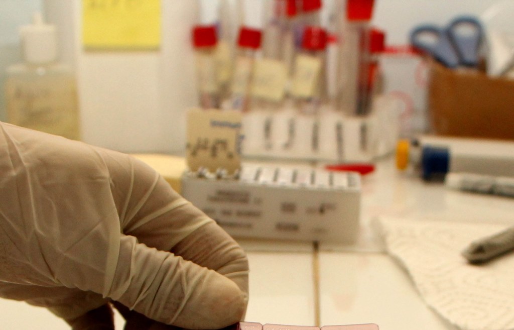 Las pruebas para detección de zika se efectúan en el laboratorio nacional del Ministerio de Salud, en la capital. (Foto Prensa Libre: Rolando Miranda)