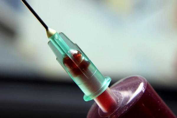 mediante el análisis de sangre se hace un termograma de plasma que podría servir para detectar algunas enfermedades, entre estas lupus y artritis.