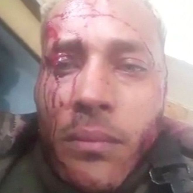 Pérez envió videos a su cuenta de Instagram en los que denunciaba el asedio policial y lucía ensangrentado. REUTERS