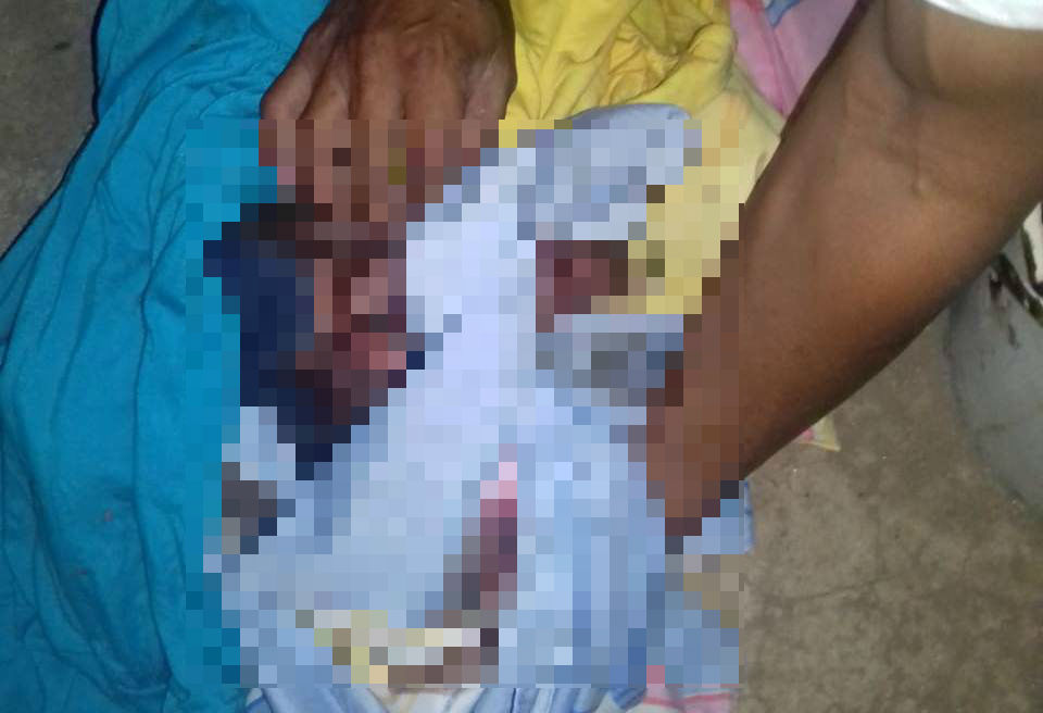 La recién nacida fue recatada de la fosa séptica y llevada a un hospital. (Foto Prensa Libre: Mario Morales)