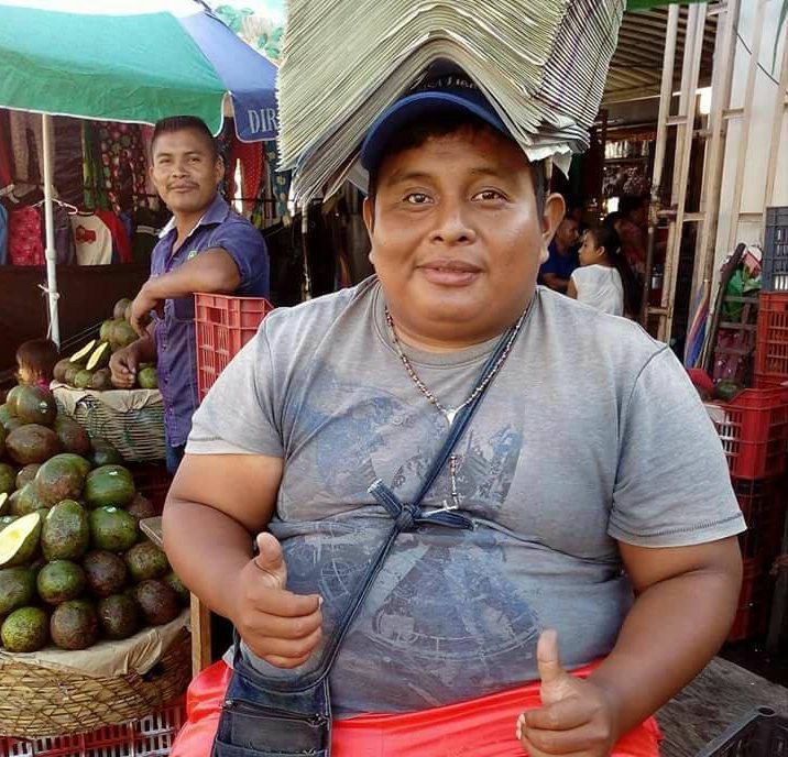 Wil Jordán Flores, de 26 años, resultó herido al oponerse a asalto. (Foto Prensa Libre: Mario Morales)