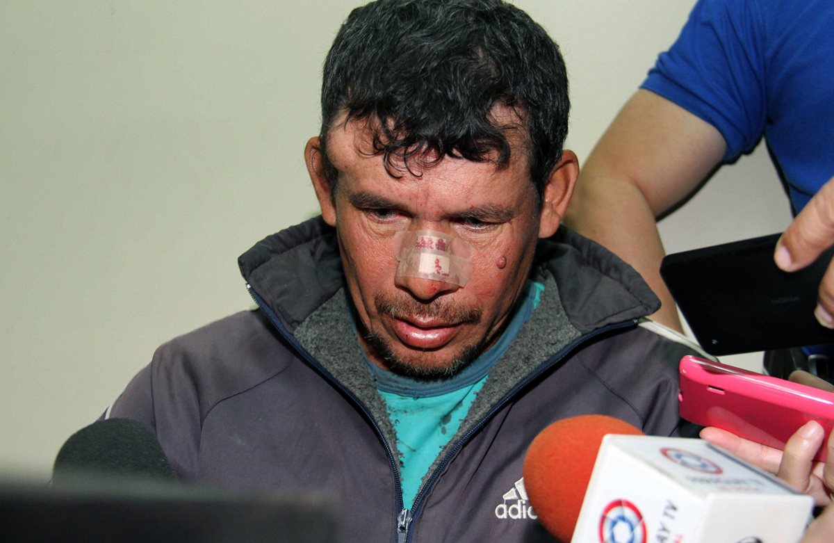 Gilberto Benítez habla con los medios, es acusado de violación y podría enfrentar una pena de 15 años de cárcel. (Foto Prensa Libre: AFP).