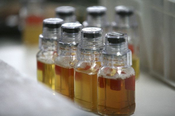 La Agencia Mundial Antidopaje reveló que en el 2014 hubo mil 693 positivos en todo el mundo. (Foto Prensa Libre: AP)