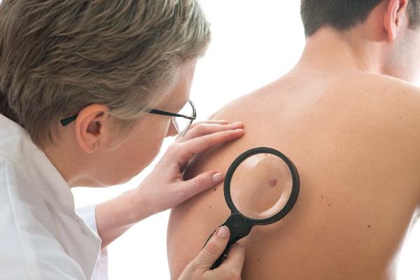 Las visitas anuales al dermatólogo son claves para la prevención.