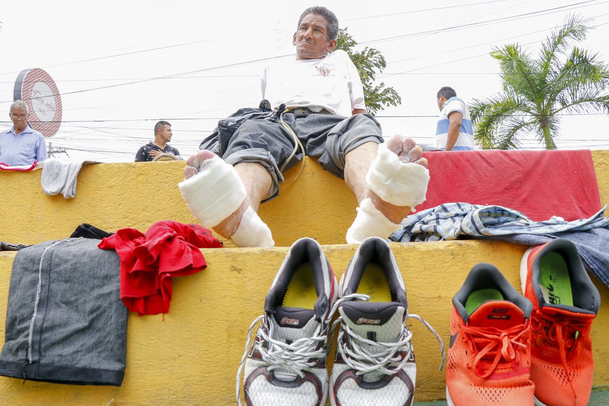 Migrante de 62 años sufrió heridas en los pies por las largas distancias recorridas