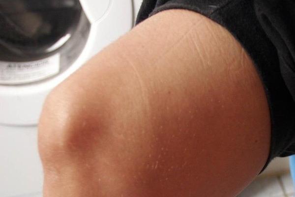 en la rodilla hay un ligamento recién descubierto.