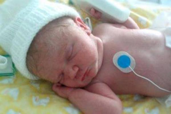 Los bebés prematuros necesitan atenciones especiales.<br _mce_bogus="1"/>