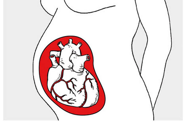 Vigilar el corazón tras varios abortos espontáneos.
