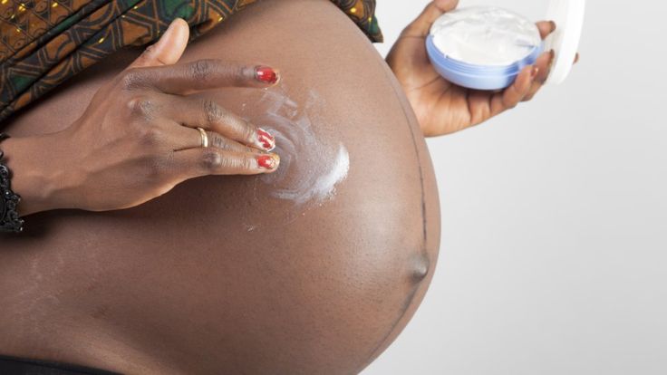 Existe el falso mito de que usando cremas blanquedoras durante el embarazo, el bebé tendrá una piel más clara, explicó la doctora Dadzie a BBC Mundo. (Getty Images).