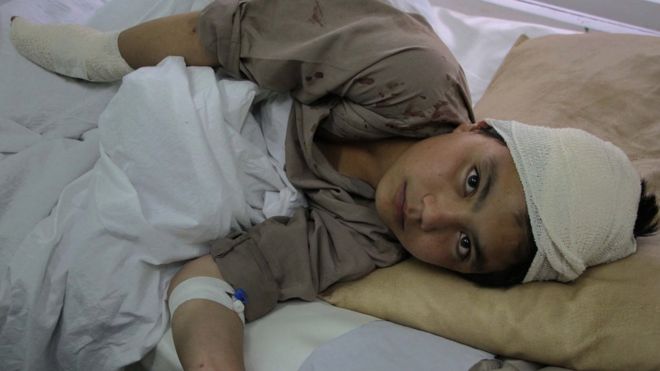 Un niño afgano en el hospital tras un ataque del Talibán en Kabul, en abril de 2016. GETTY IMAGES