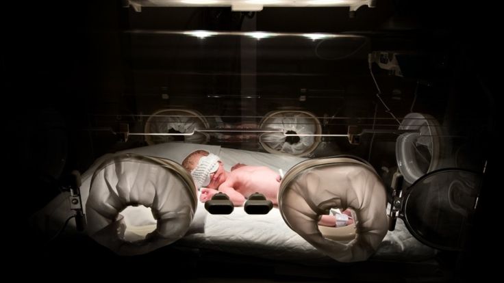 La evidencia muestra que su vida está mejor protegida si ingiere Bifidobacterium infantis. (Getty Images)