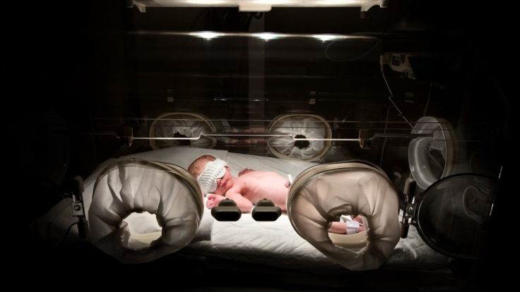 La evidencia muestra que su vida está mejor protegida si ingiere Bifidobacterium infantis. (Getty Images)