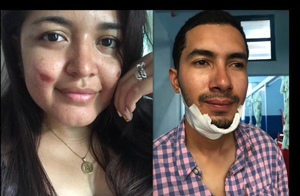 Los esposos Mario Colindres y Marcela Hintz solo resultaron con golpes leves en el accidente del bus, en el kilómetro 214, El Jute, Los Amates, Izabal. (Foto Prensa Libre: Tomada de Facebook)
