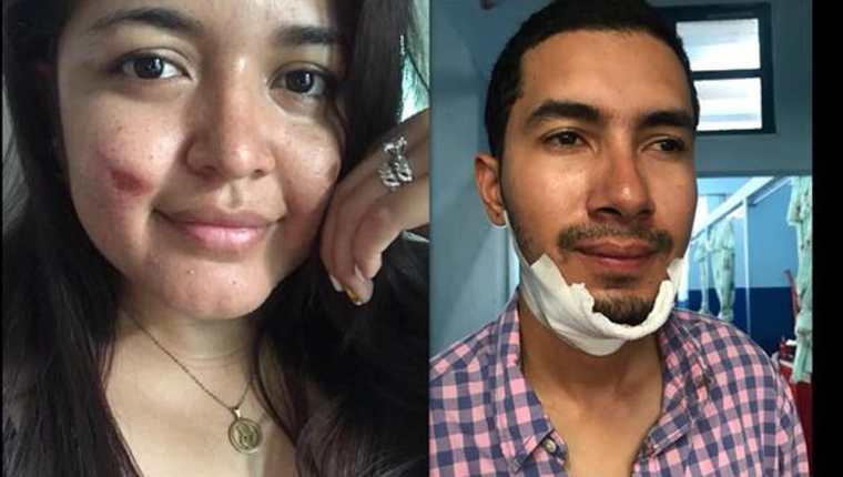 Los esposos Mario Colindres y Marcela Hintz solo resultaron con golpes leves en el accidente del bus, en el kilómetro 214, El Jute, Los Amates, Izabal. (Foto Prensa Libre: Tomada de Facebook)