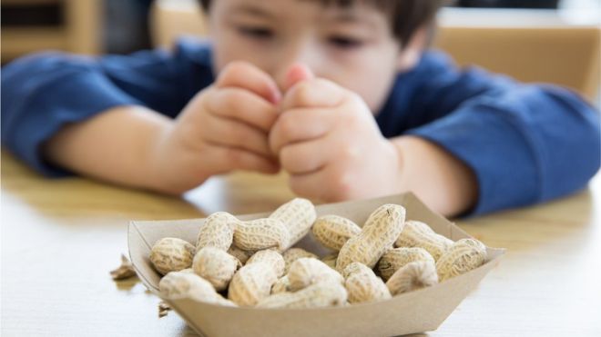 La alergia a los cacahuetes o maníes es una de las más frecuentes en el mundo (GETTY IMAGES).