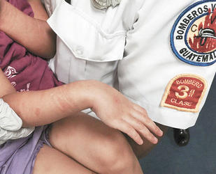 La menor es atendida por Bomberos Voluntarios y trasladada al Hospital General. (Foto Prensa Libre: CVB)
