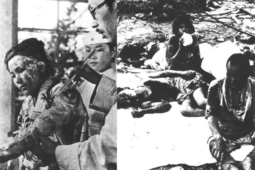 Los efectos secundarios de la radiación después del bombardeo nuclear a Japón cobraron miles de víctimas. (Foto: Hemeroteca PL)