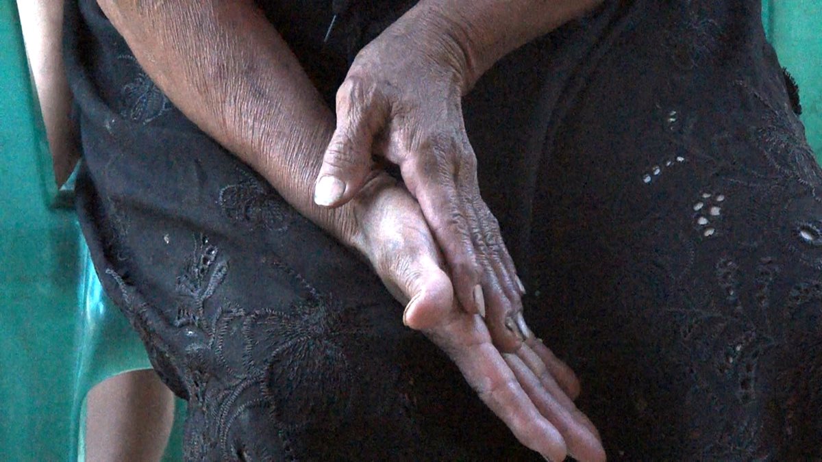 Las manos de Candelaria son la prueba de las largas jornadas de trabajo en el campo. (Foto Prensa Libre: Beatriz Tercero)