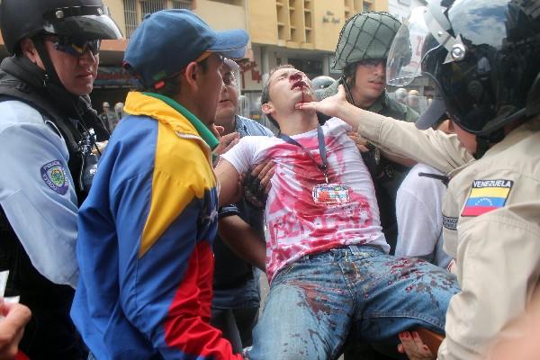 En San Cristóbal las protestas degeneraron en violencia, al menos cinco resultaron golpeados, uno de ellos de gravedad. (Foto Prensa Libre: AFP).