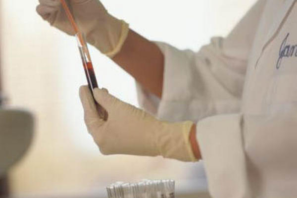 <br _mce_bogus="1"/>