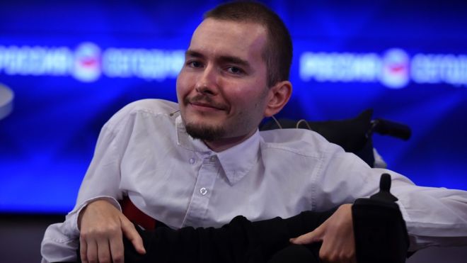 Valery Spiridonov, el hombre que quiere someterse al primer trasplante de cabeza en la historia