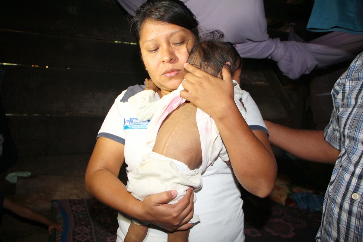 Una trabajadora de Salud sostiene a un niño rescatado en Nuevo San Carlos, Retalhuleu, en julio de 2015, por desnutrición crónica. (Foto Prensa Libre: Hemeroteca PL)