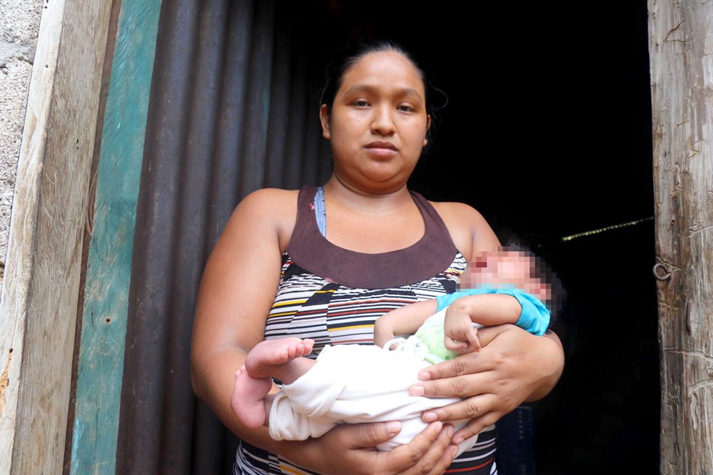 Mariana Díaz carga a su hijo Humberto Yordani Cabrera Díaz, quien padece malformaciones en las manos y los pies. (Foto Prensa Libre: Rolando Miranda)
