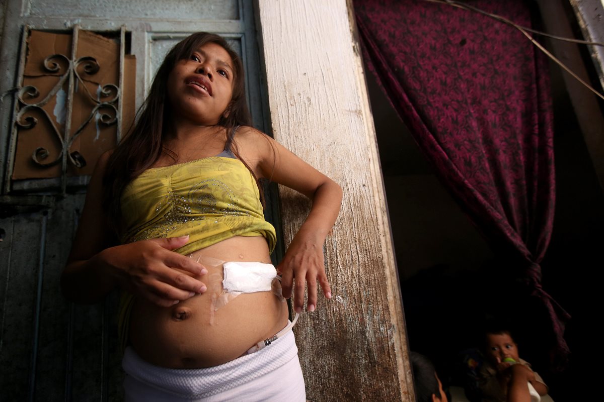 Graciela González Jacob de 23 años, quien vive con diálisis debido al agua contaminada de las comunidades de San Pedro Itzicán y Agua Caliente. (Foto Prensa Libre: EFE).
