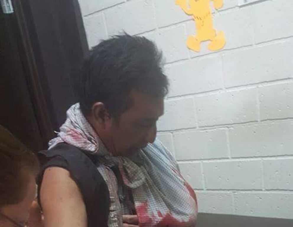 Doroteo Elías fue atacado por un cocodrilo en Las Cruces, Petén. (Foto Prensa Libre: Rigoberto Escobar).