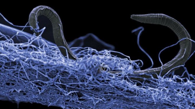 Un nemátodo o gusano cilíndrico sobre una película de otros organismos. Los organismos subterráneos son diminutos, pero colectivamente representan casi el doble del volumen de todos los océanos del planeta. (Foto Prensa Libre;GETTY IMAGES)