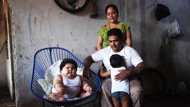Luis Manuel nació en Tecoma, en el estado de Colima. El bebé tuvo un peso normal al nacer, de 3,58 kilos. Pero al mes ya era un niño obeso. AFP