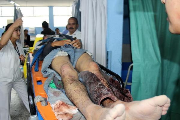 La víctima fue localizada luego de tres días de permanecer desaparecido. (Foto Prensa Libre: Óscar Figueroa)<br _mce_bogus="1"/>