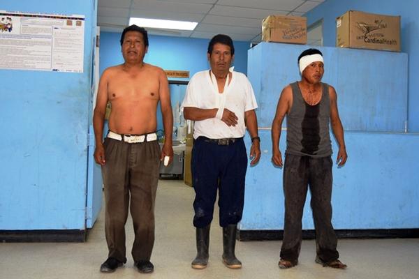 Julio Méndez, Miguel Méndez y Adán      Méndez, heridos en enfrentamiento. (Foto Prensa Libre: Óscar Figueroa)