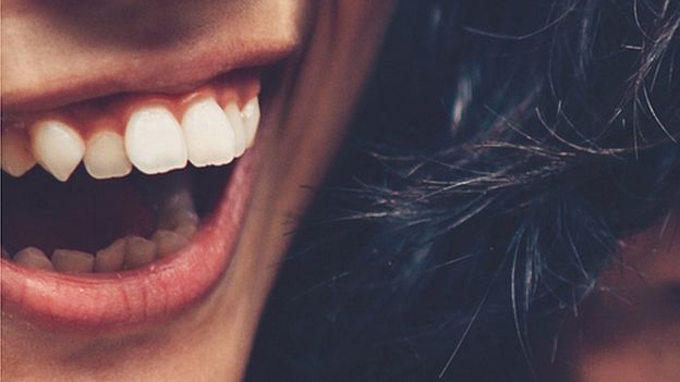 El colmillo puntudo es típico de yaeba, así como los dientes desalineados. GETTY IMAGES