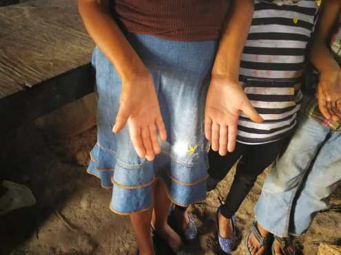 Las manos de Marta son testigo de las largar horas de trabajo en el campo, tarea que le permite ganar Q50 diarios. (Foto Prensa Libre: Beatriz Tercero)