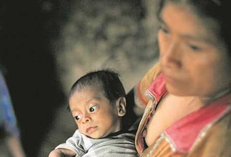 La pobreza y desnutrición persiste en cinco municipios pese a altas ejecuciones ediles (Foto: Prensa Libre: Archivo)