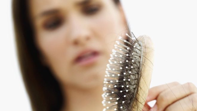 ¿Por qué se nos cae el cabello y cuándo debemos verlo como un alarmante signo de alopecia o una enfermedad?